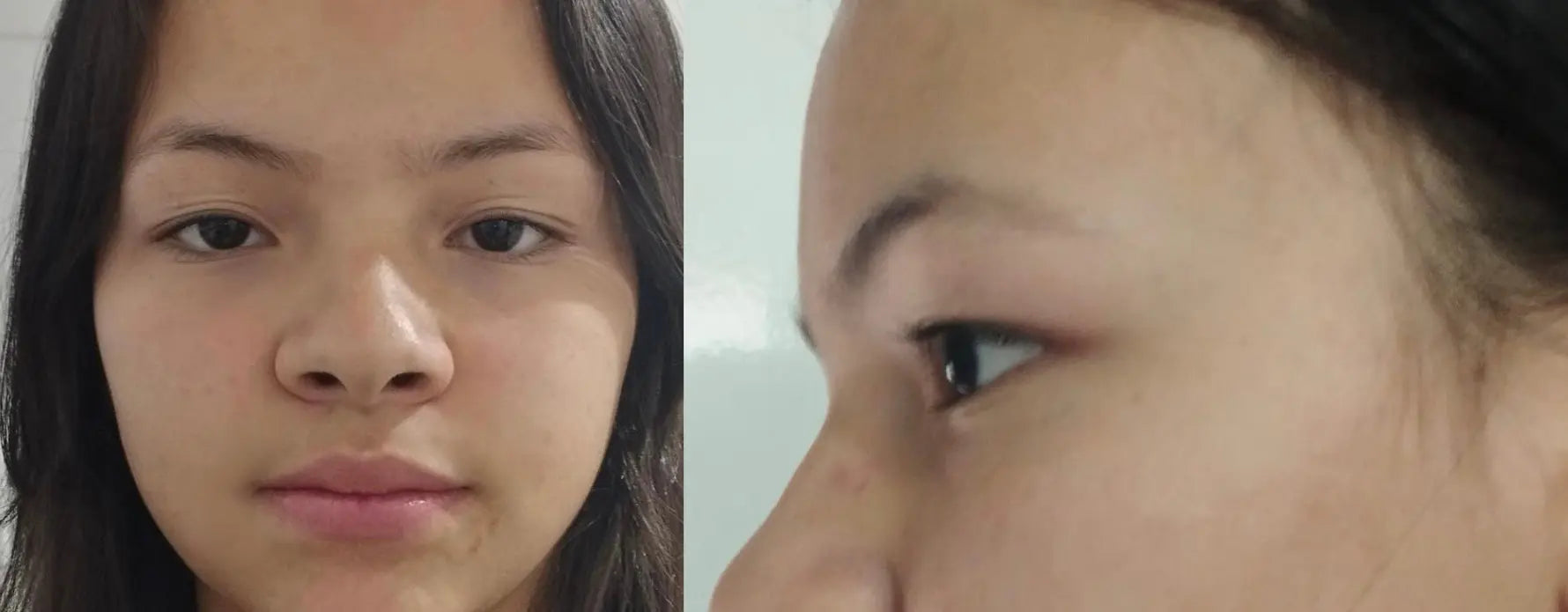 resultados-2 - Laboderm Skincare
